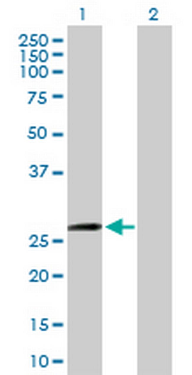 ZFYVE21 Antibody in Western Blot (WB)