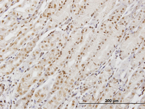 DDX54 Antibody in Immunohistochemistry (Paraffin) (IHC (P))