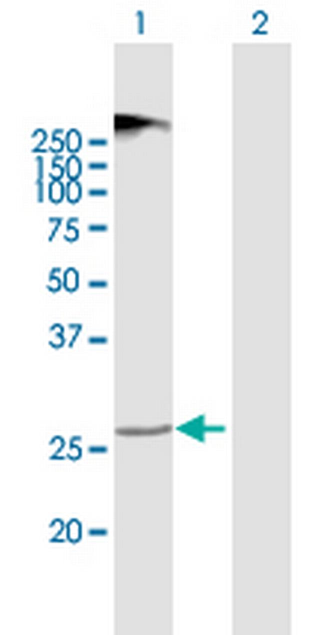 TMEM38A Antibody in Western Blot (WB)