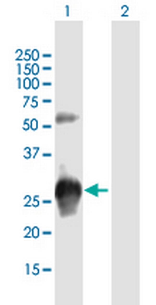 KCTD15 Antibody in Western Blot (WB)
