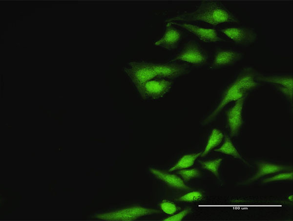 ASPSCR1 Antibody in Immunocytochemistry (ICC/IF)
