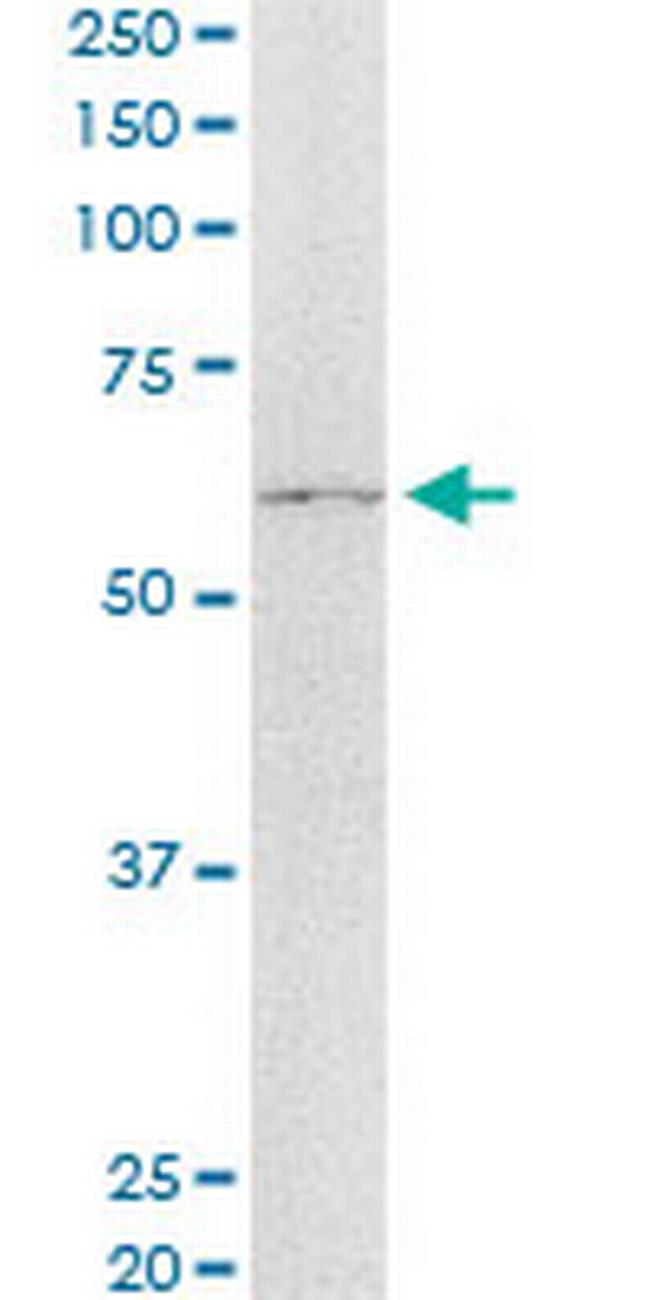 ASPSCR1 Antibody in Western Blot (WB)