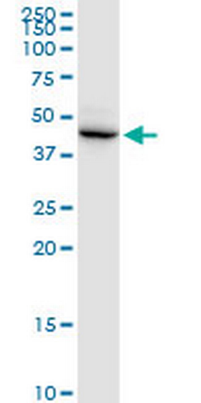 DSCC1 Antibody in Western Blot (WB)