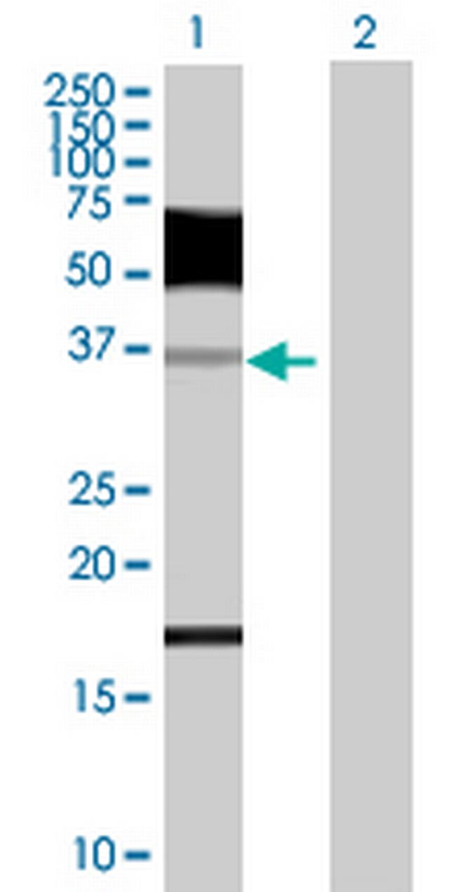 ZNF426 Antibody in Western Blot (WB)