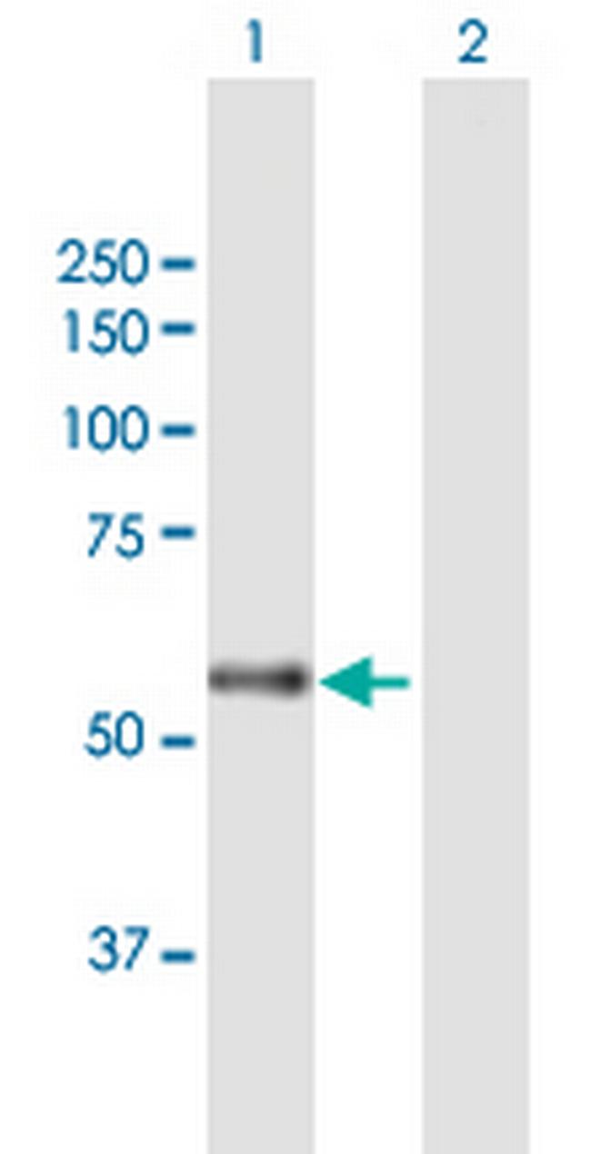 CARD14 Antibody in Western Blot (WB)