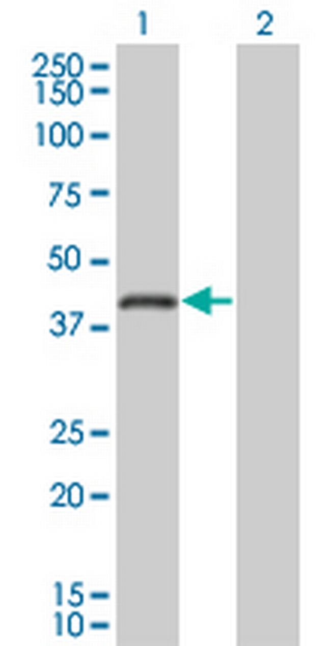RNF26 Antibody in Western Blot (WB)