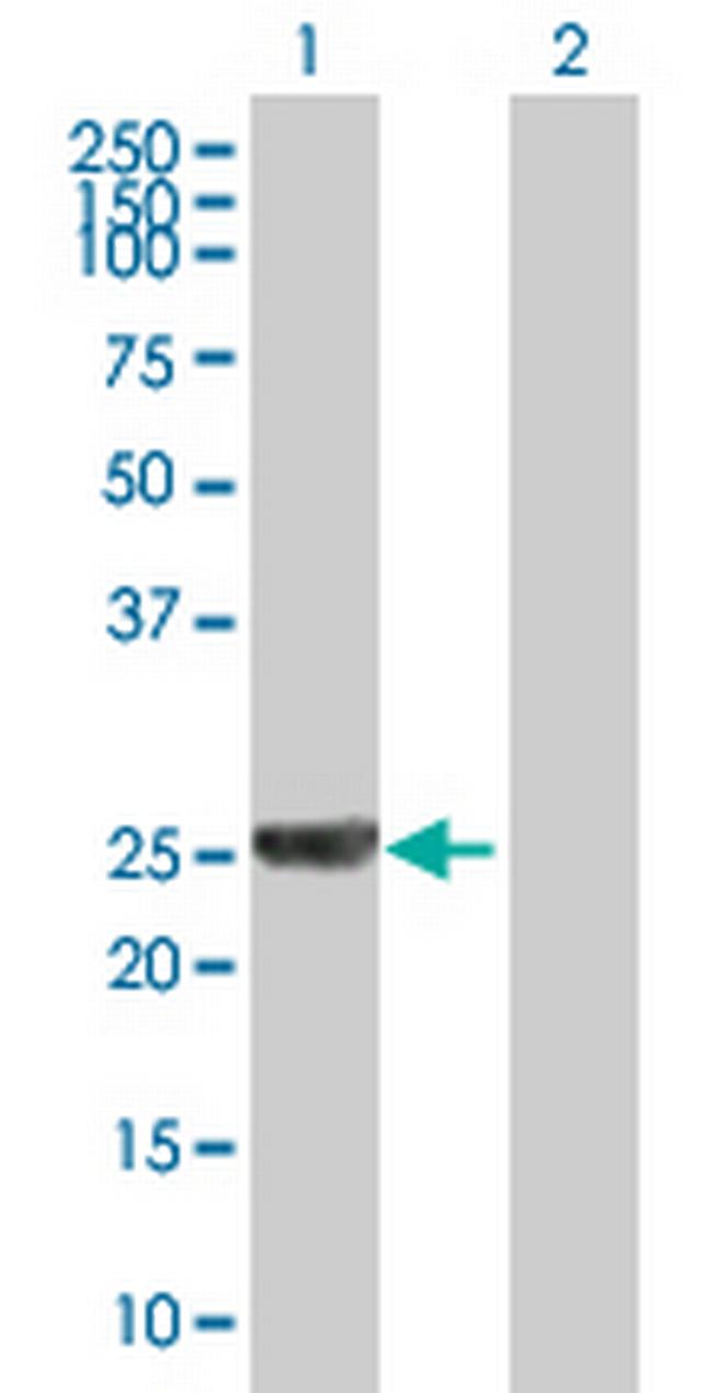 CCDC28B Antibody in Western Blot (WB)