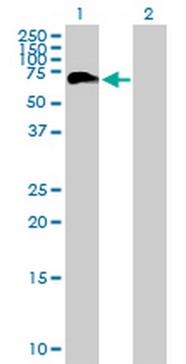 PHF23 Antibody in Western Blot (WB)