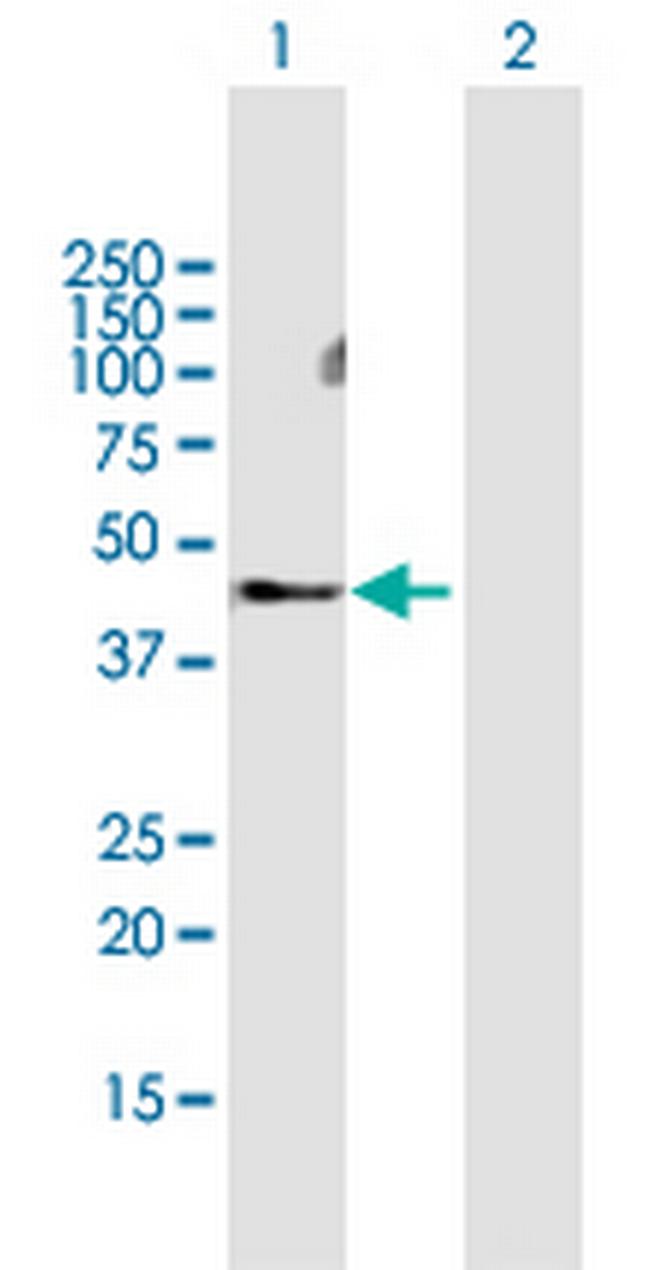 MMP28 Antibody in Western Blot (WB)