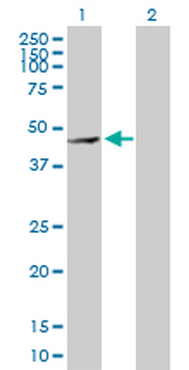 MMP28 Antibody in Western Blot (WB)