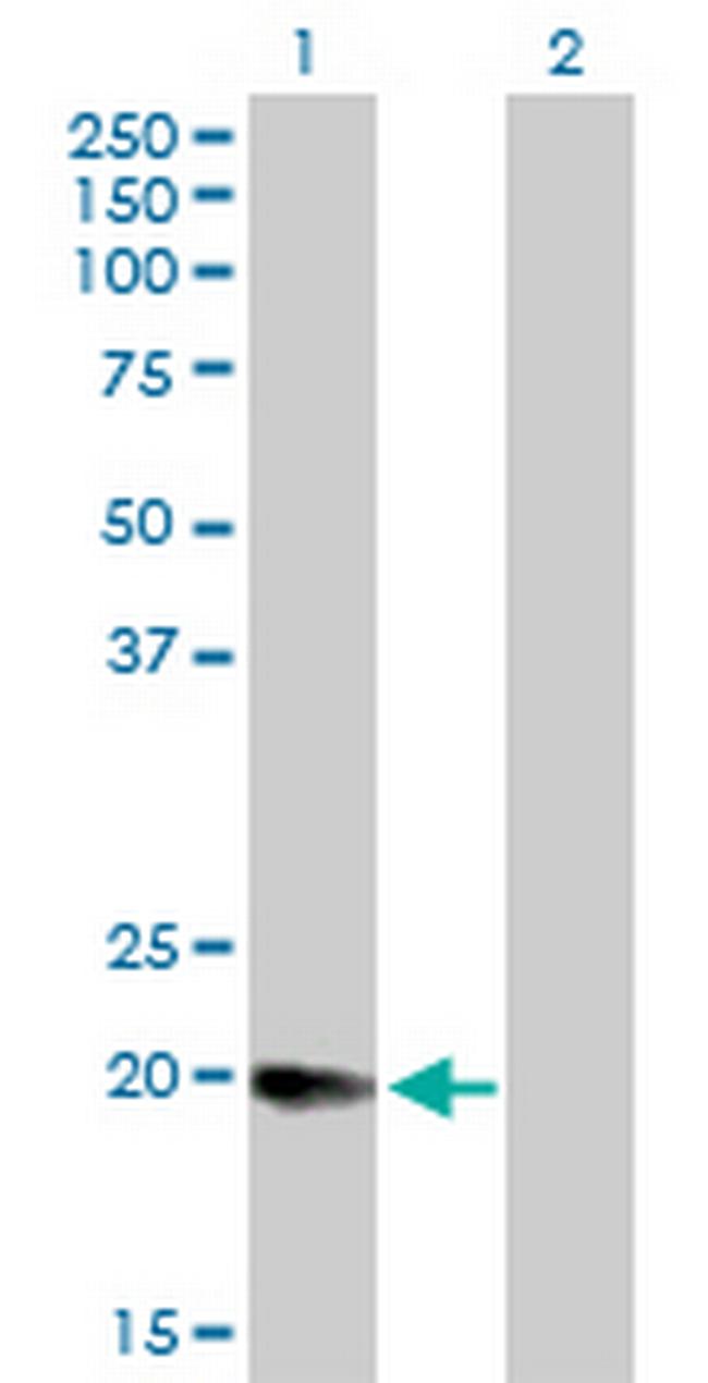 MGC4172 Antibody in Western Blot (WB)