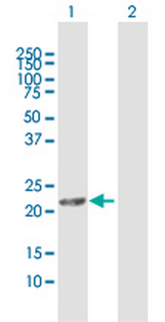 DHRS11 Antibody in Western Blot (WB)