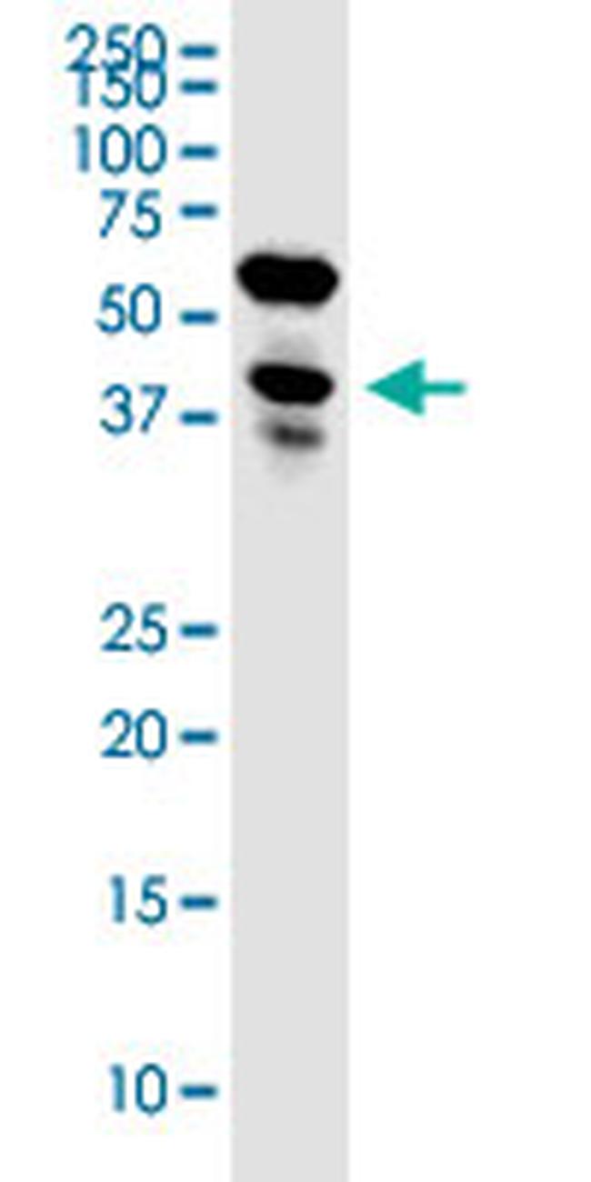 LENG1 Antibody in Western Blot (WB)