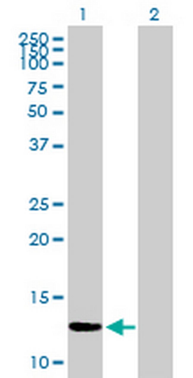 ZNF343 Antibody in Western Blot (WB)