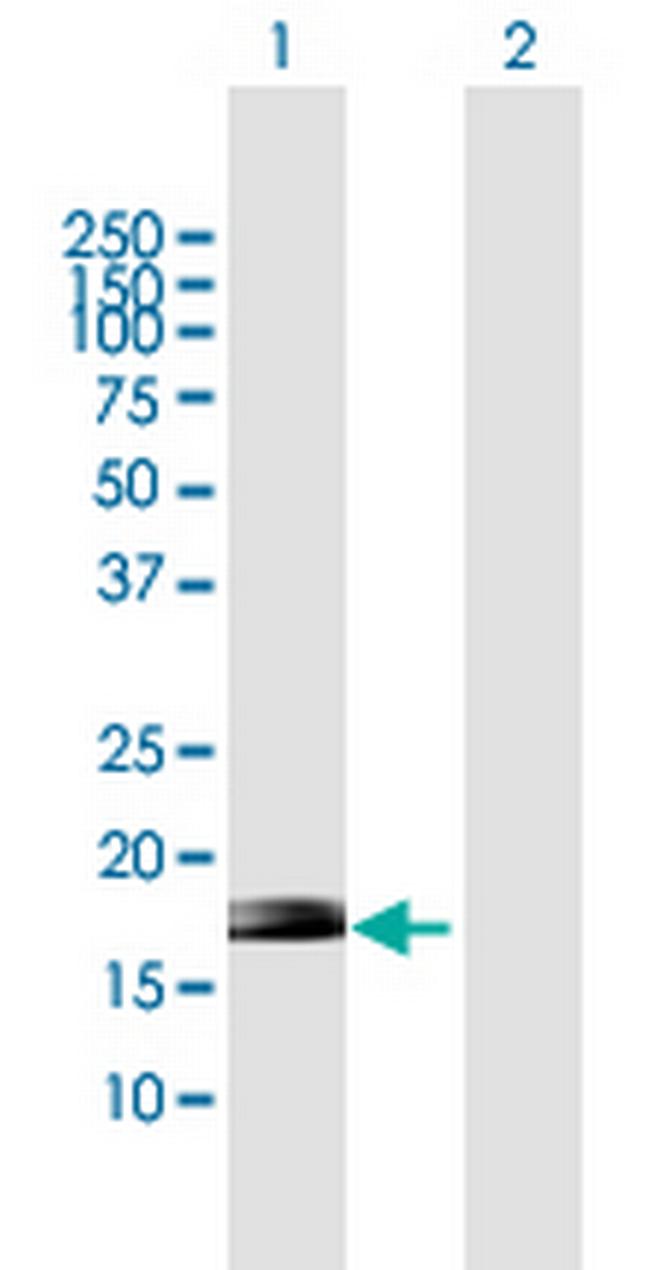ZNF576 Antibody in Western Blot (WB)