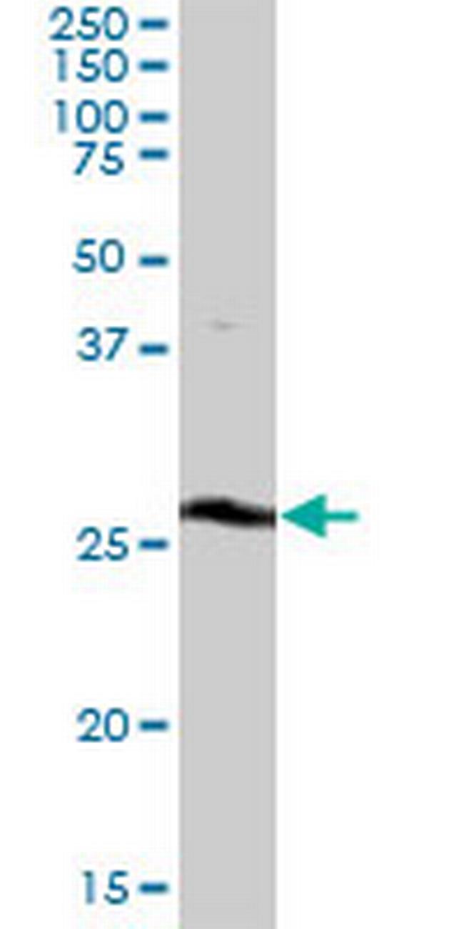 THTPA Antibody in Western Blot (WB)