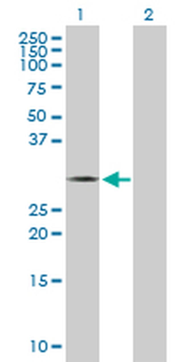 THTPA Antibody in Western Blot (WB)