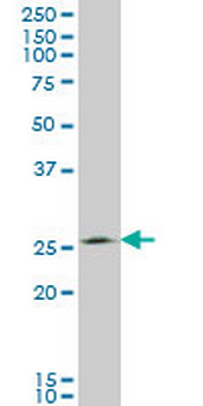 THTPA Antibody in Western Blot (WB)