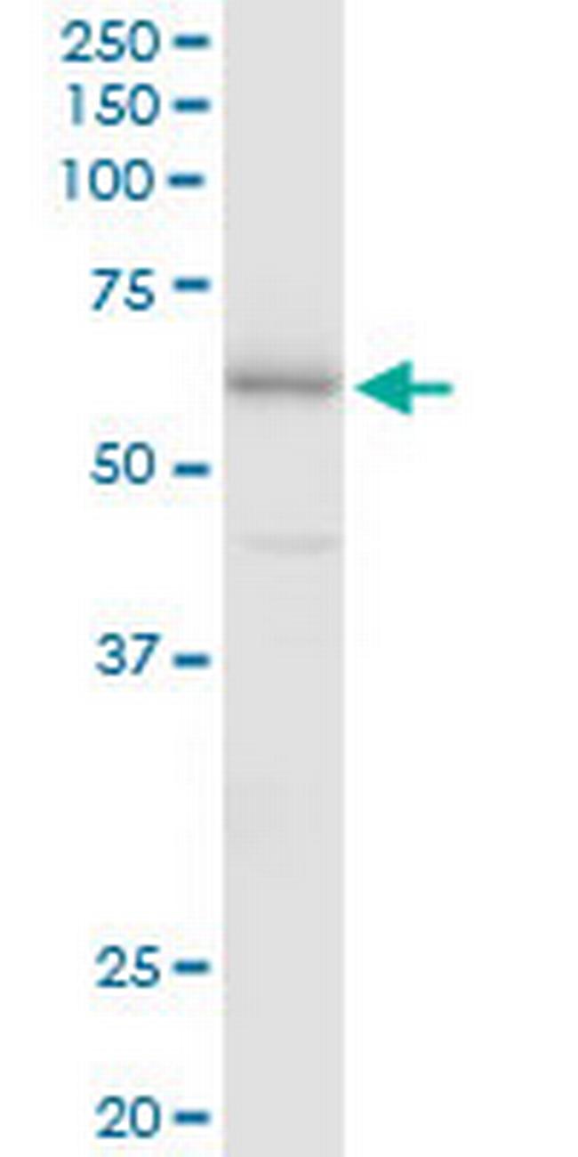 FSD1 Antibody in Western Blot (WB)