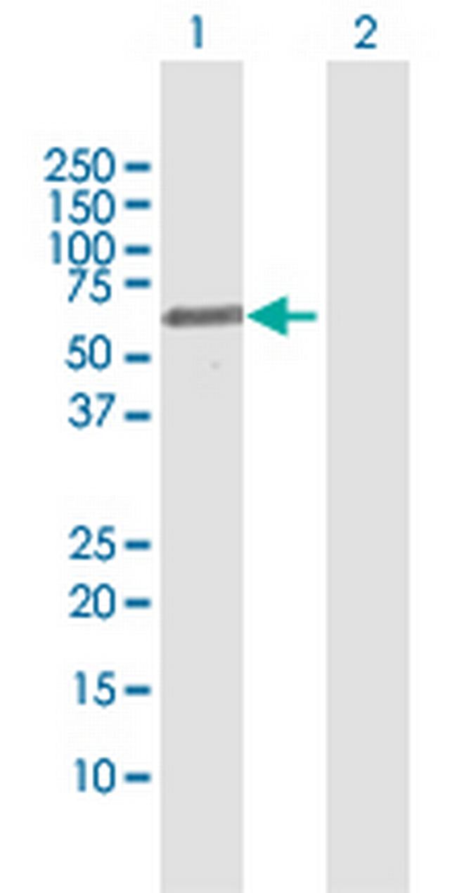 FSD1 Antibody in Western Blot (WB)