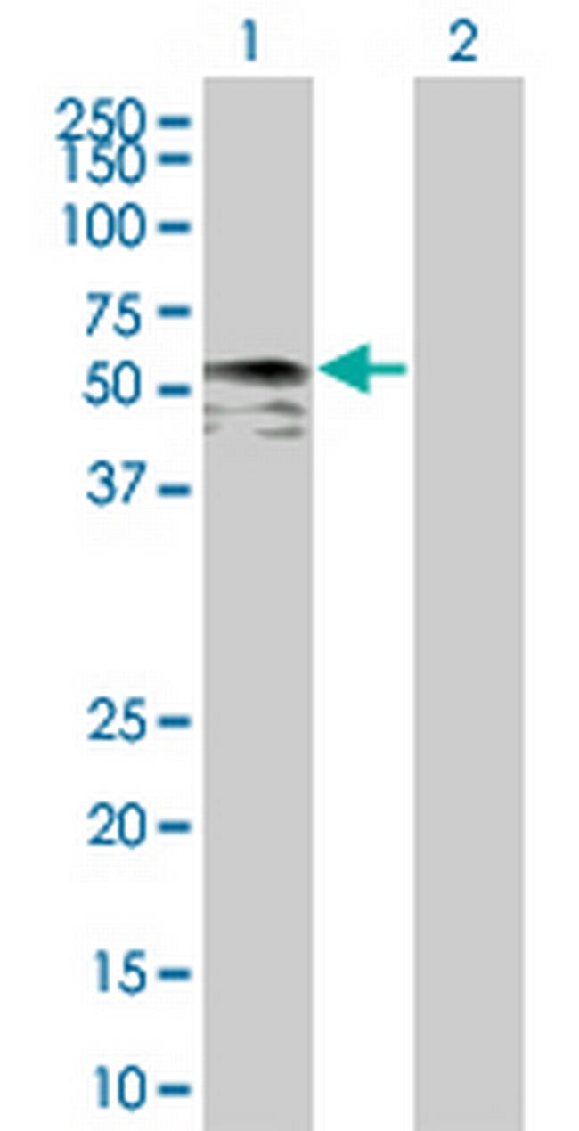 IRX6 Antibody in Western Blot (WB)