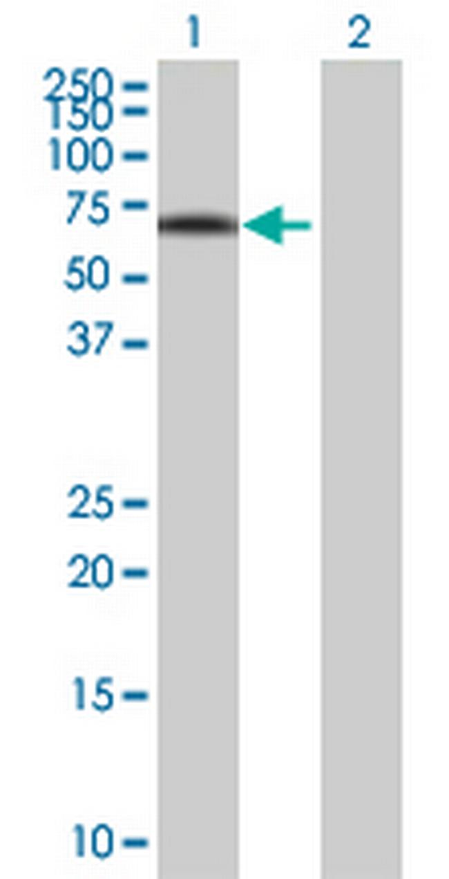 IRX3 Antibody in Western Blot (WB)