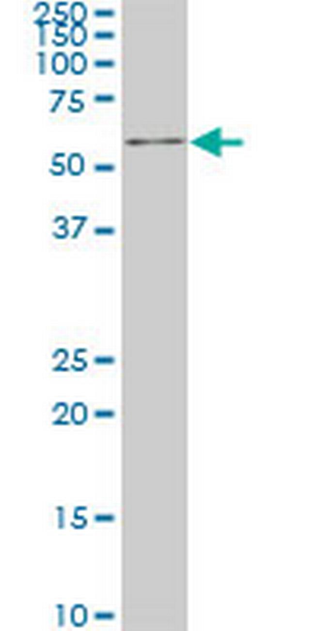 IRX3 Antibody in Western Blot (WB)