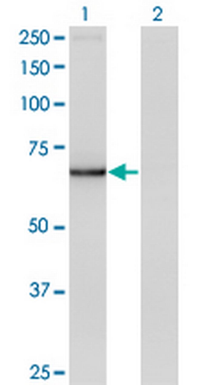 IRX3 Antibody in Western Blot (WB)