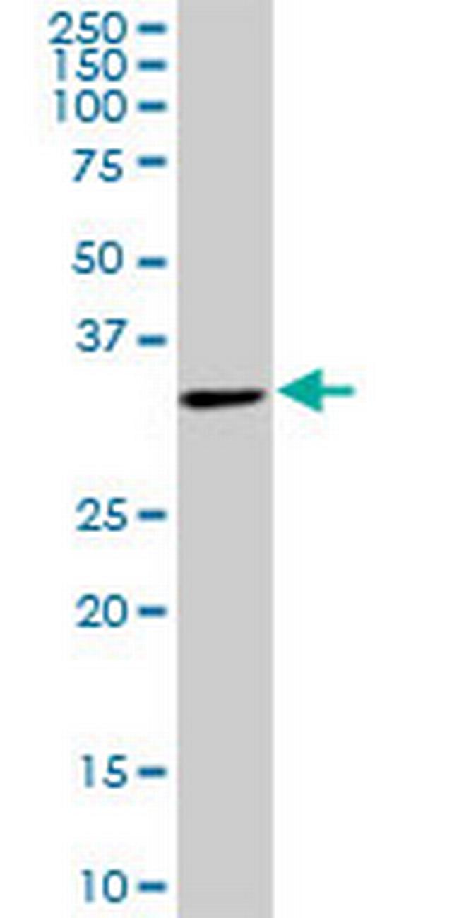 WDR58 Antibody in Western Blot (WB)