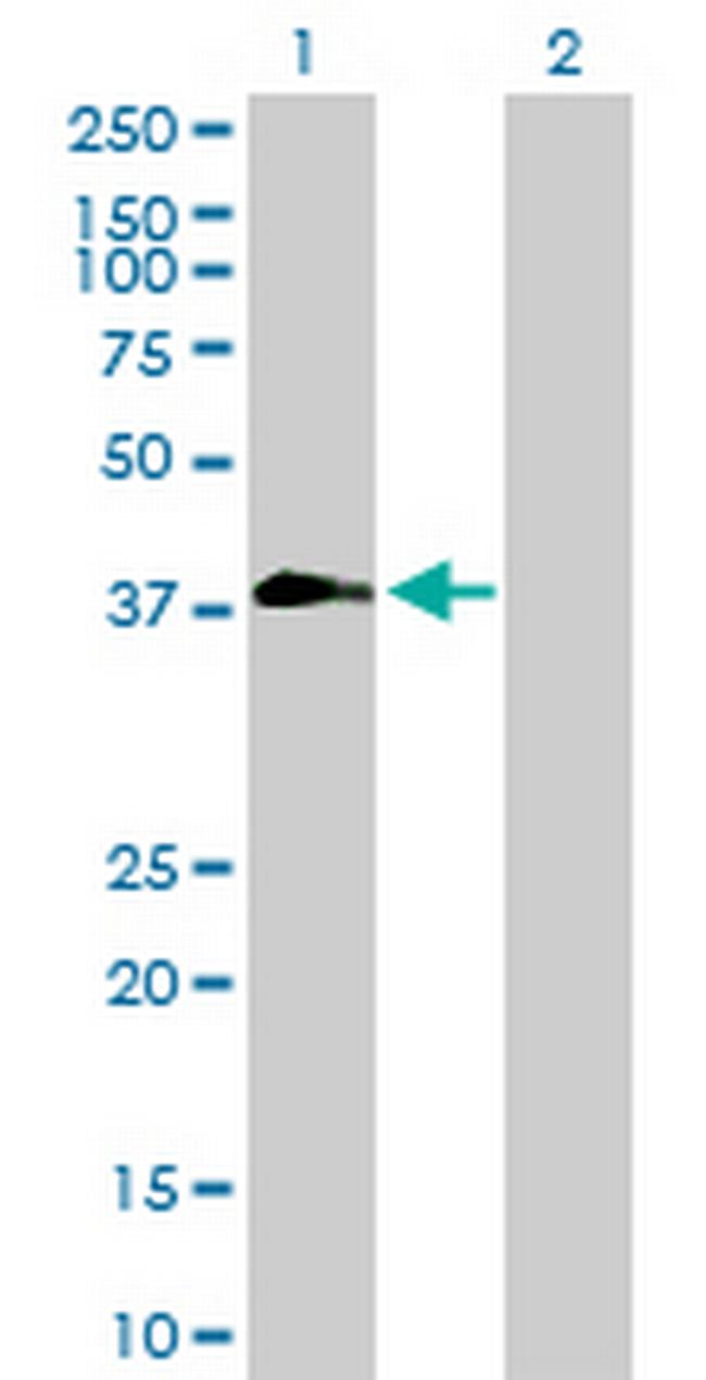 ZNF557 Antibody in Western Blot (WB)
