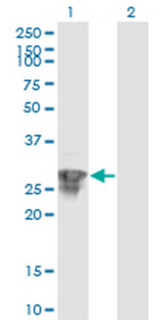 C1orf89 Antibody in Western Blot (WB)