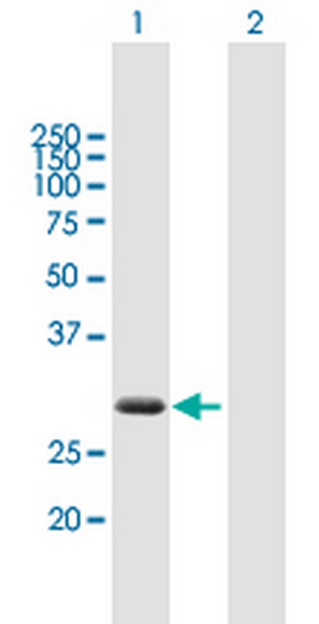 ZBED2 Antibody in Western Blot (WB)