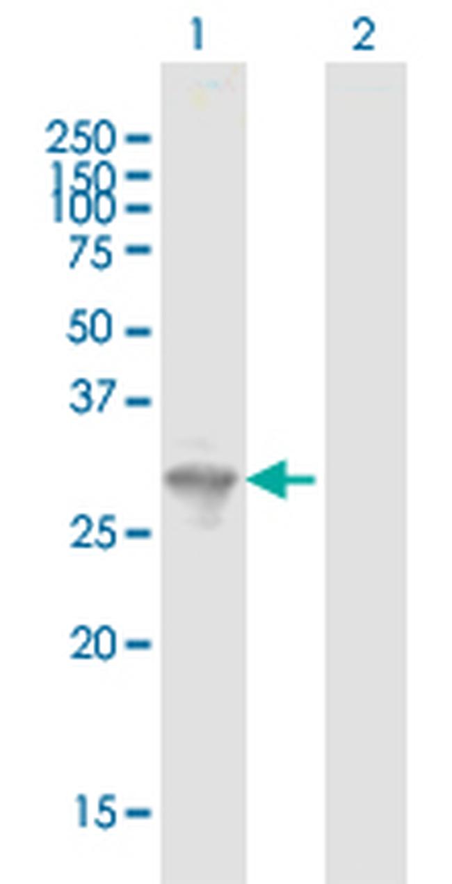 FYCO1 Antibody in Western Blot (WB)