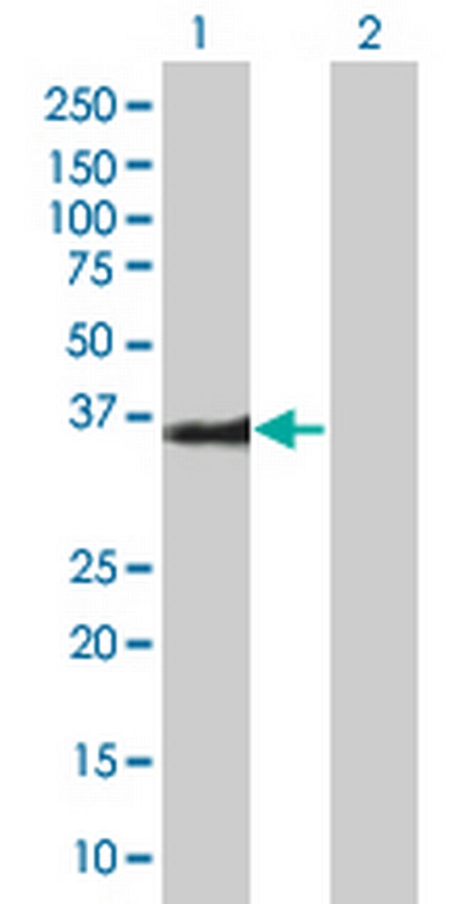 BIRC7 Antibody in Western Blot (WB)