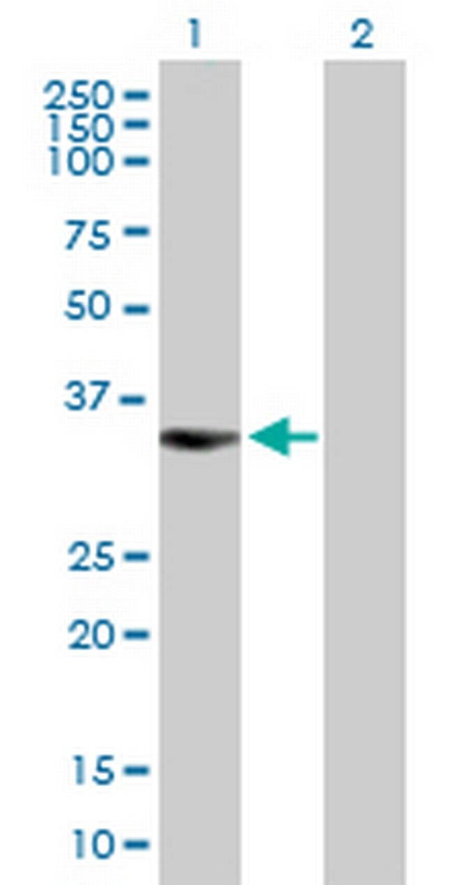 BIRC7 Antibody in Western Blot (WB)