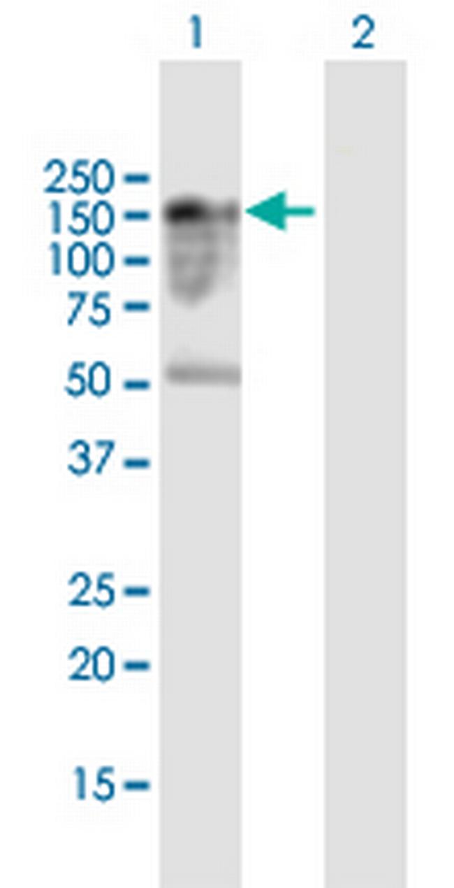FAM65A Antibody in Western Blot (WB)