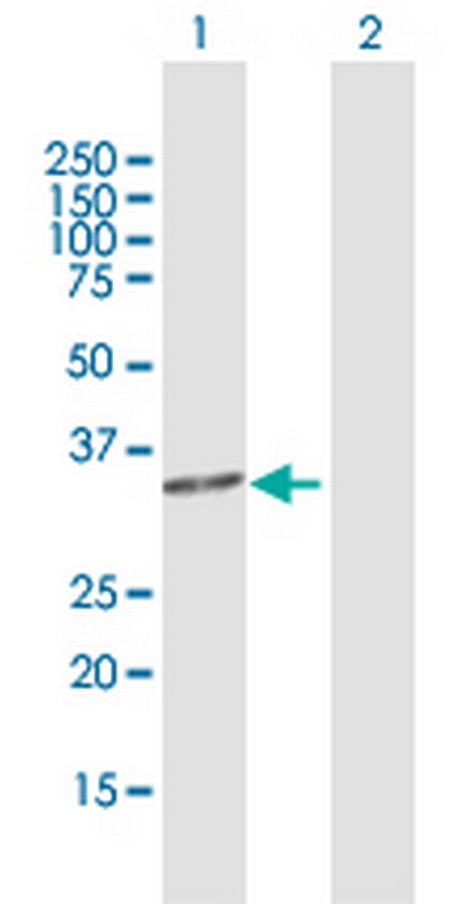 C2orf47 Antibody in Western Blot (WB)