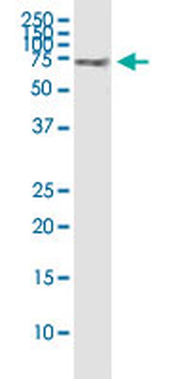 SPAG16 Antibody in Western Blot (WB)