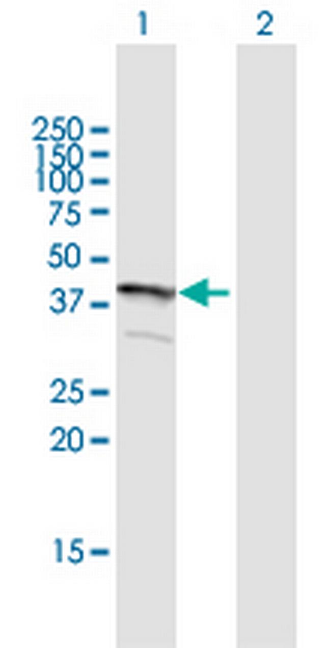 FLJ22167 Antibody in Western Blot (WB)