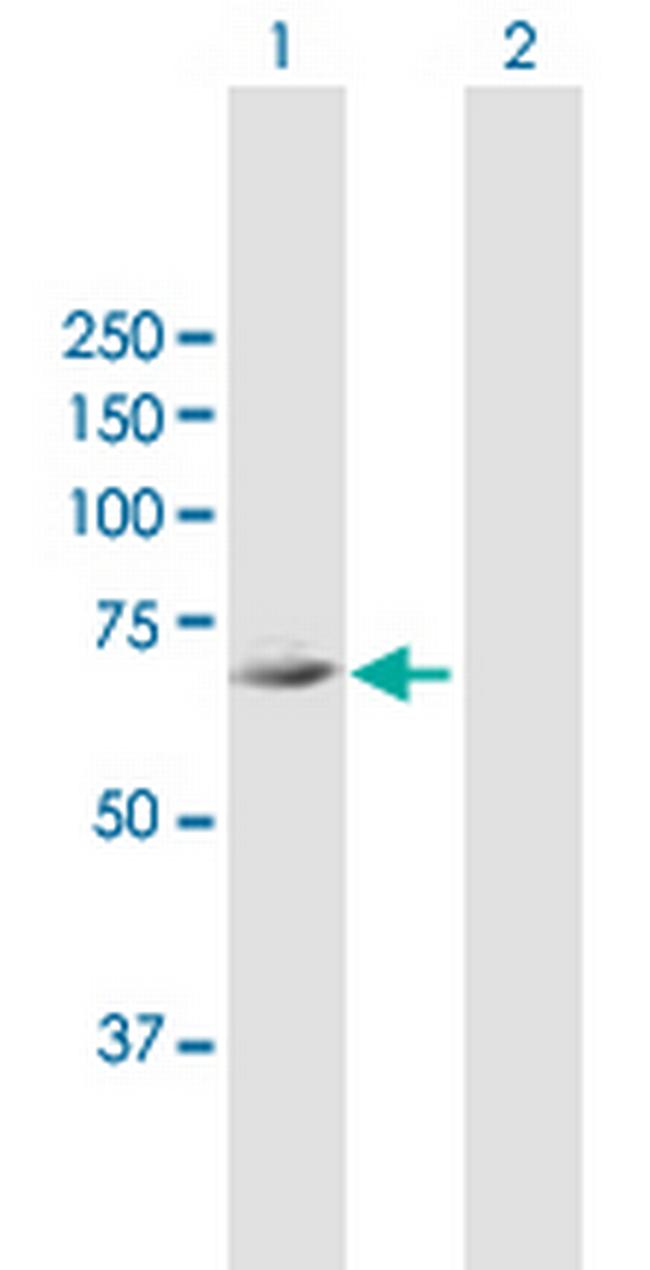 FLJ21963 Antibody in Western Blot (WB)