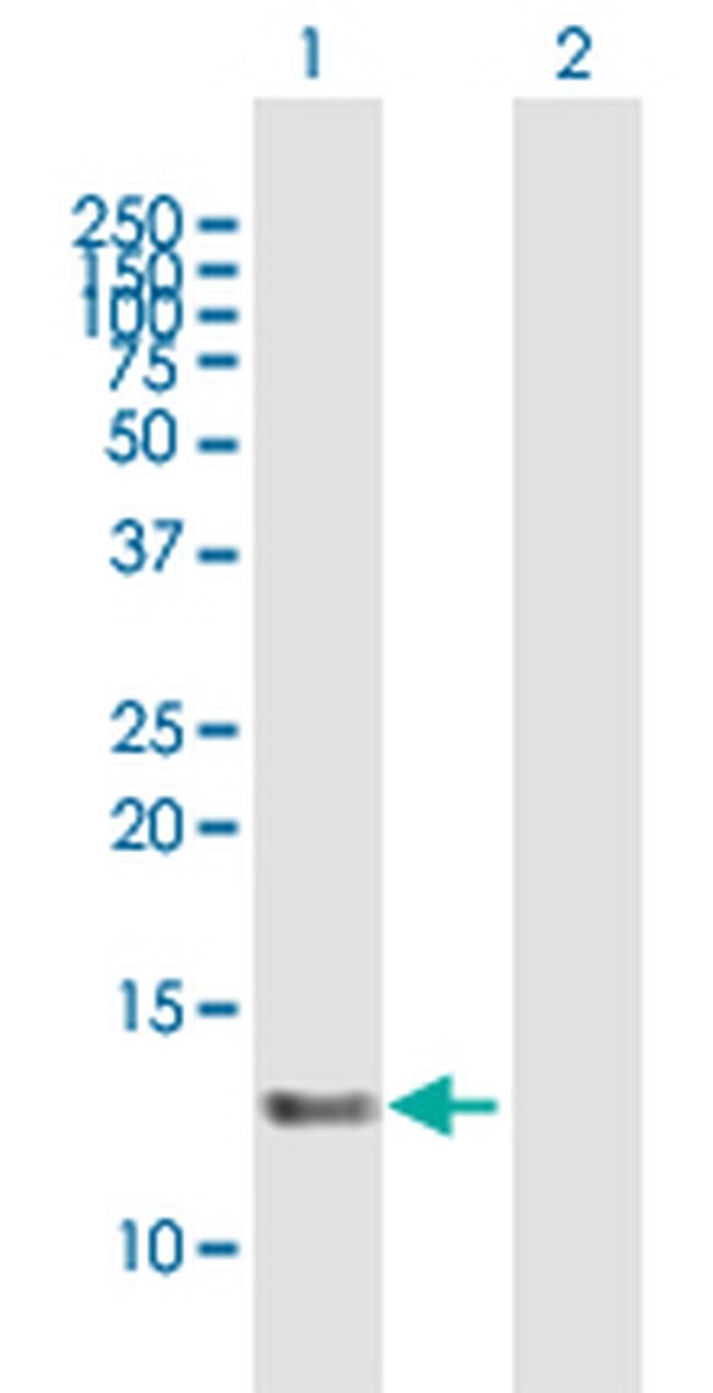 C16ORF33 Antibody in Western Blot (WB)