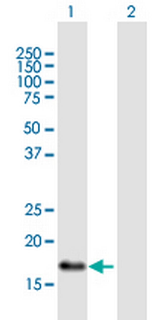 TNFAIP8L2 Antibody in Western Blot (WB)