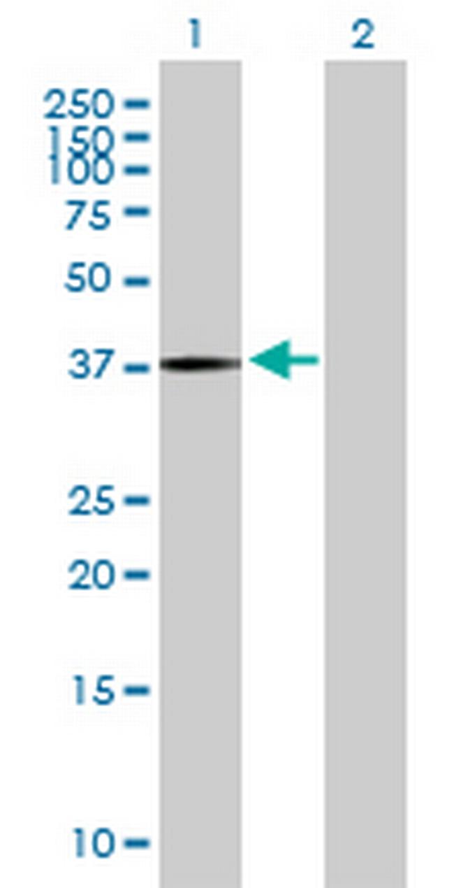 PANK3 Antibody in Western Blot (WB)