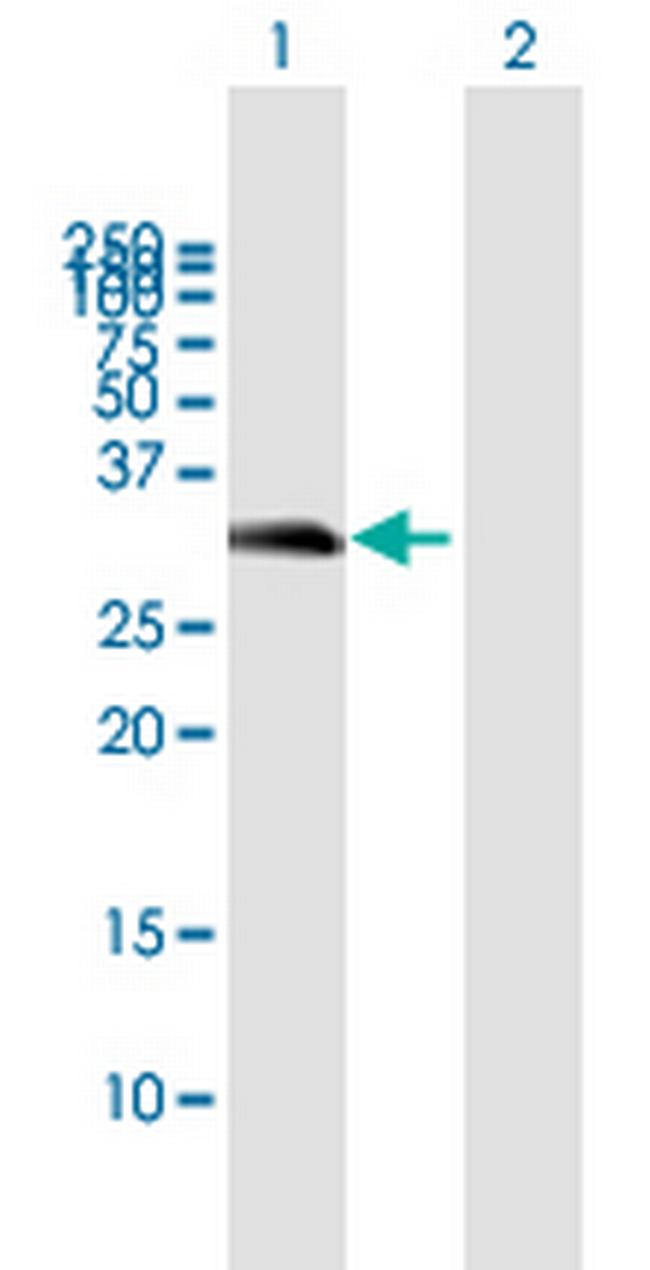 FLJ13154 Antibody in Western Blot (WB)