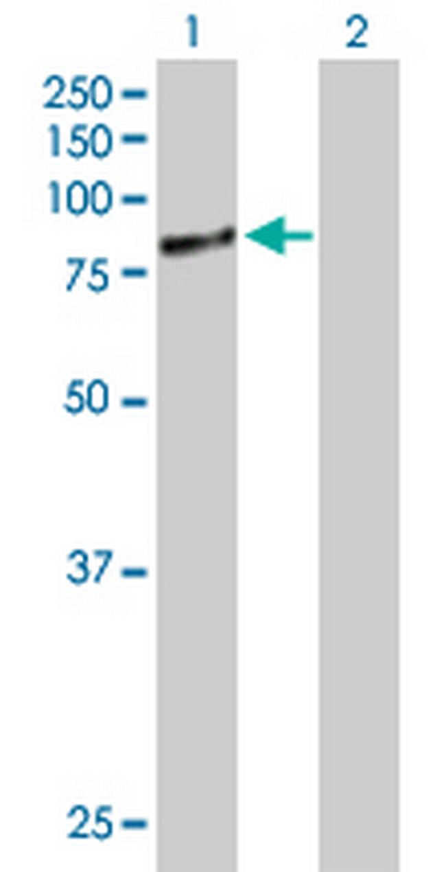 RPAP3 Antibody in Western Blot (WB)