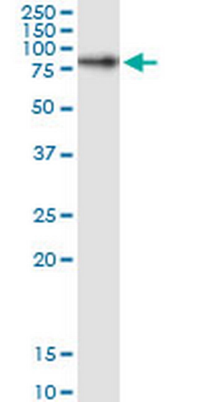 RPAP3 Antibody in Western Blot (WB)