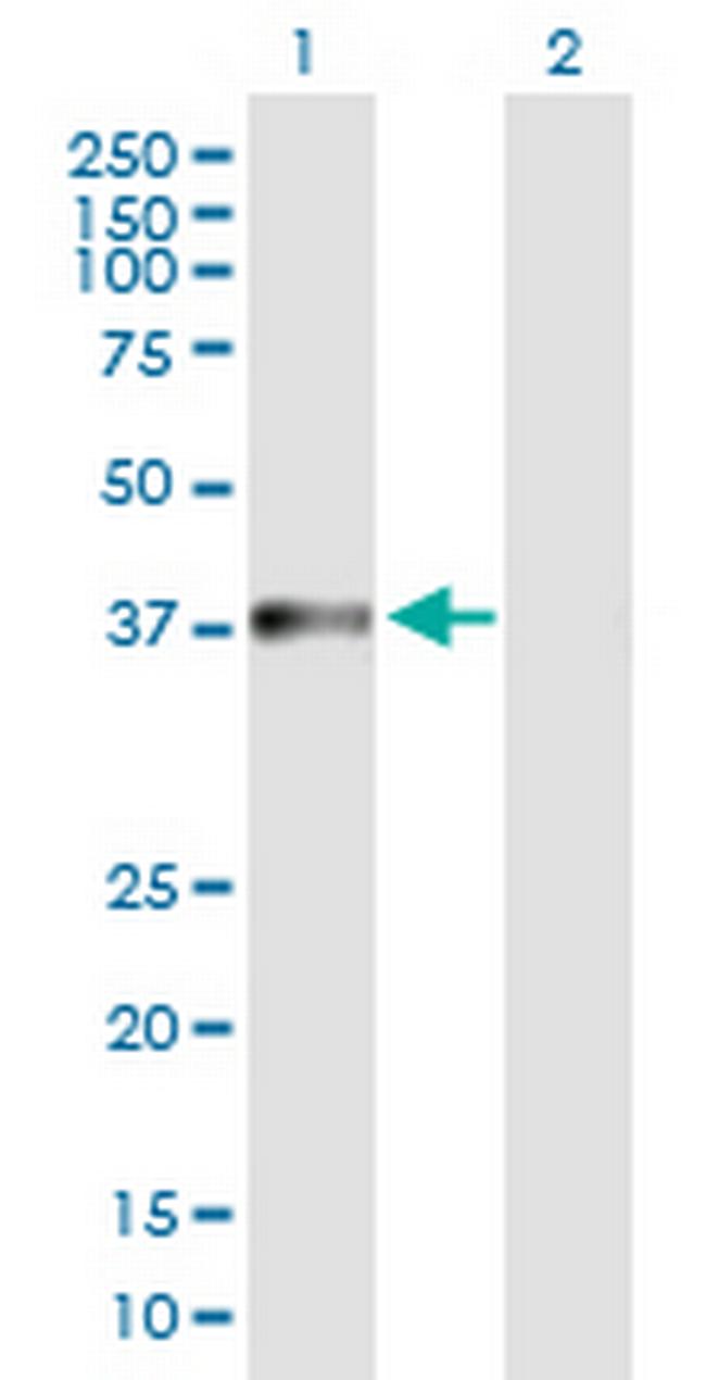 NARG2 Antibody in Western Blot (WB)