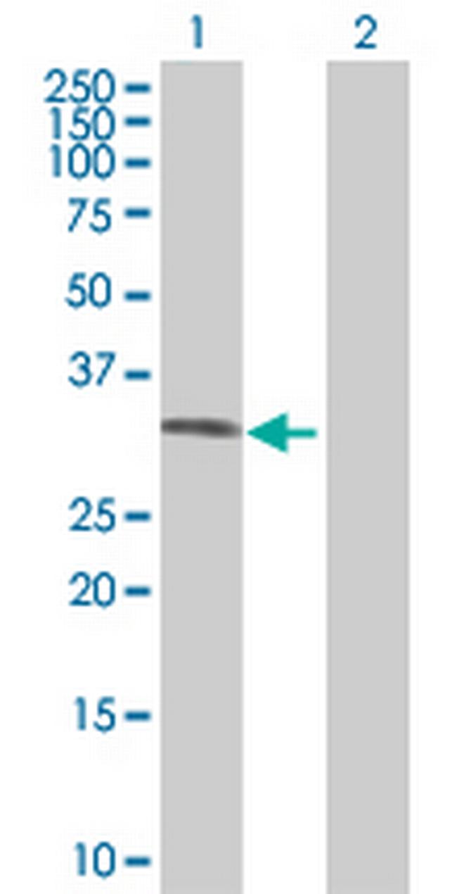 FN3KRP Antibody in Western Blot (WB)