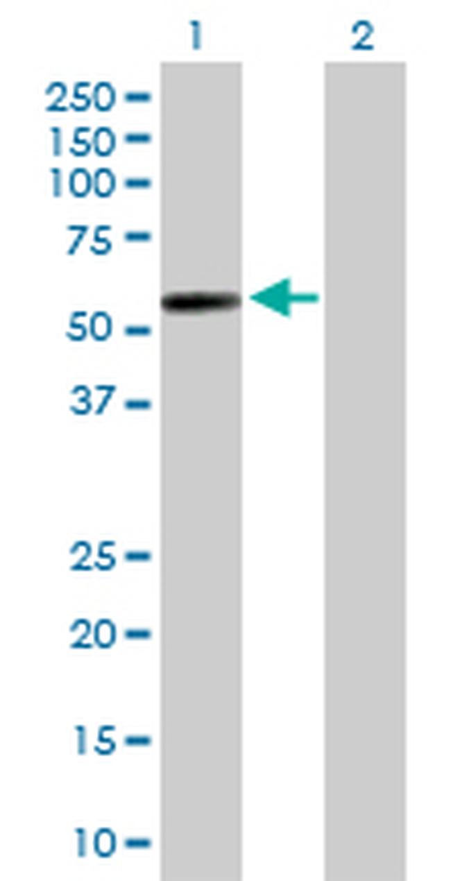 GAL3ST4 Antibody in Western Blot (WB)