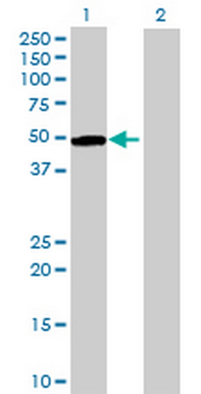 QTRTD1 Antibody in Western Blot (WB)